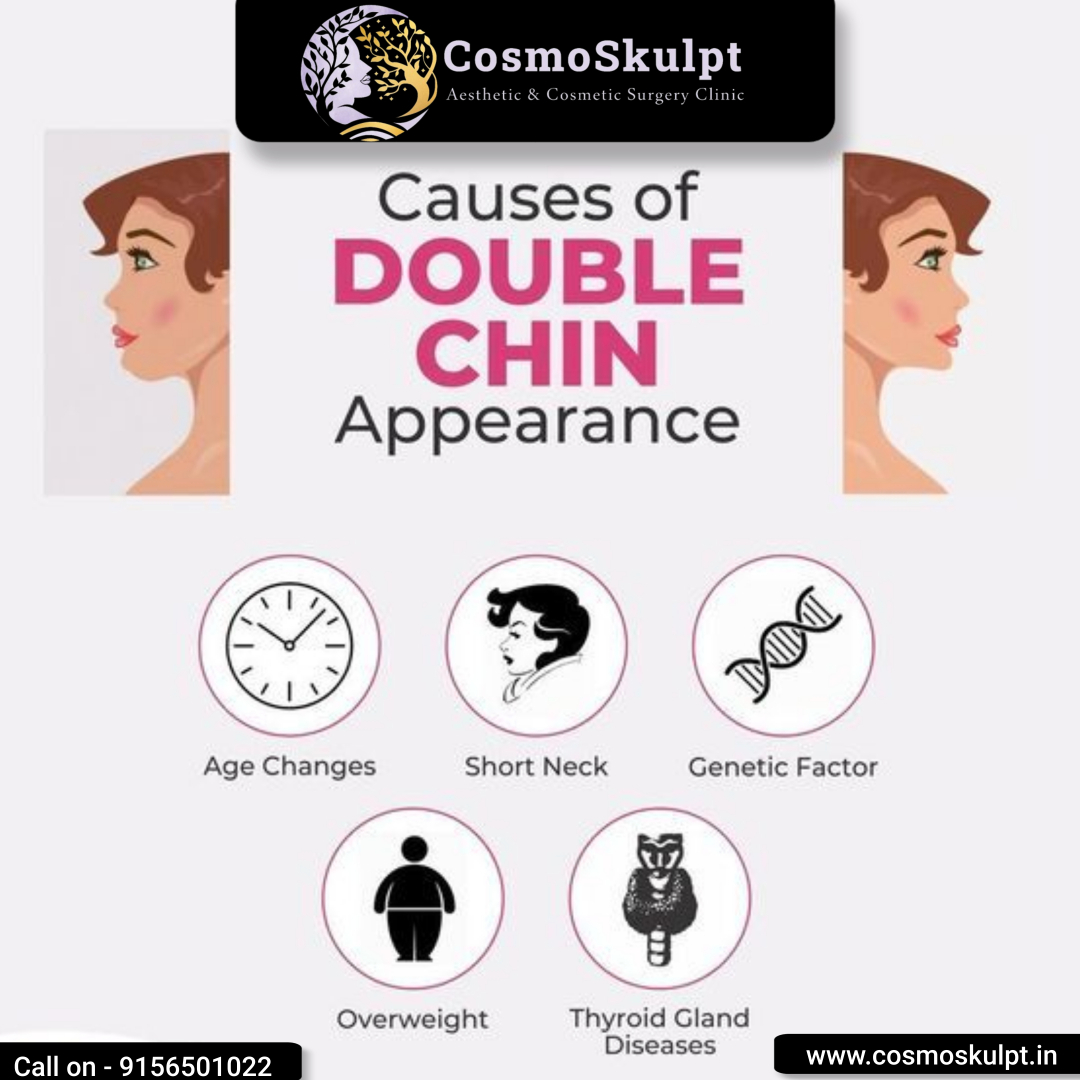 Uncover the Causes of DOUBLE CHIN Appearance