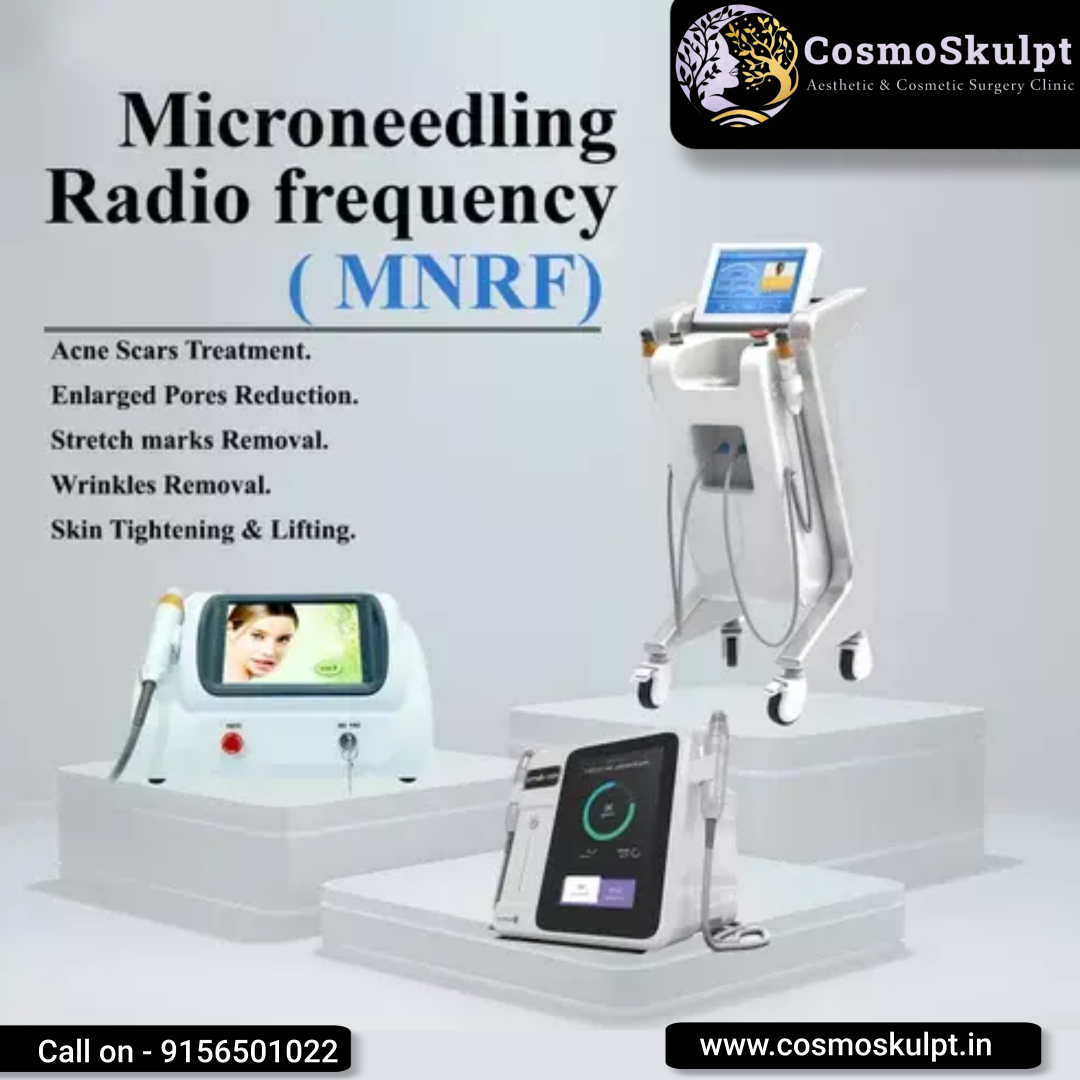 Unlock radiant skin with Microneedling Radio Frequency (MNRF) at CosmosKulpt