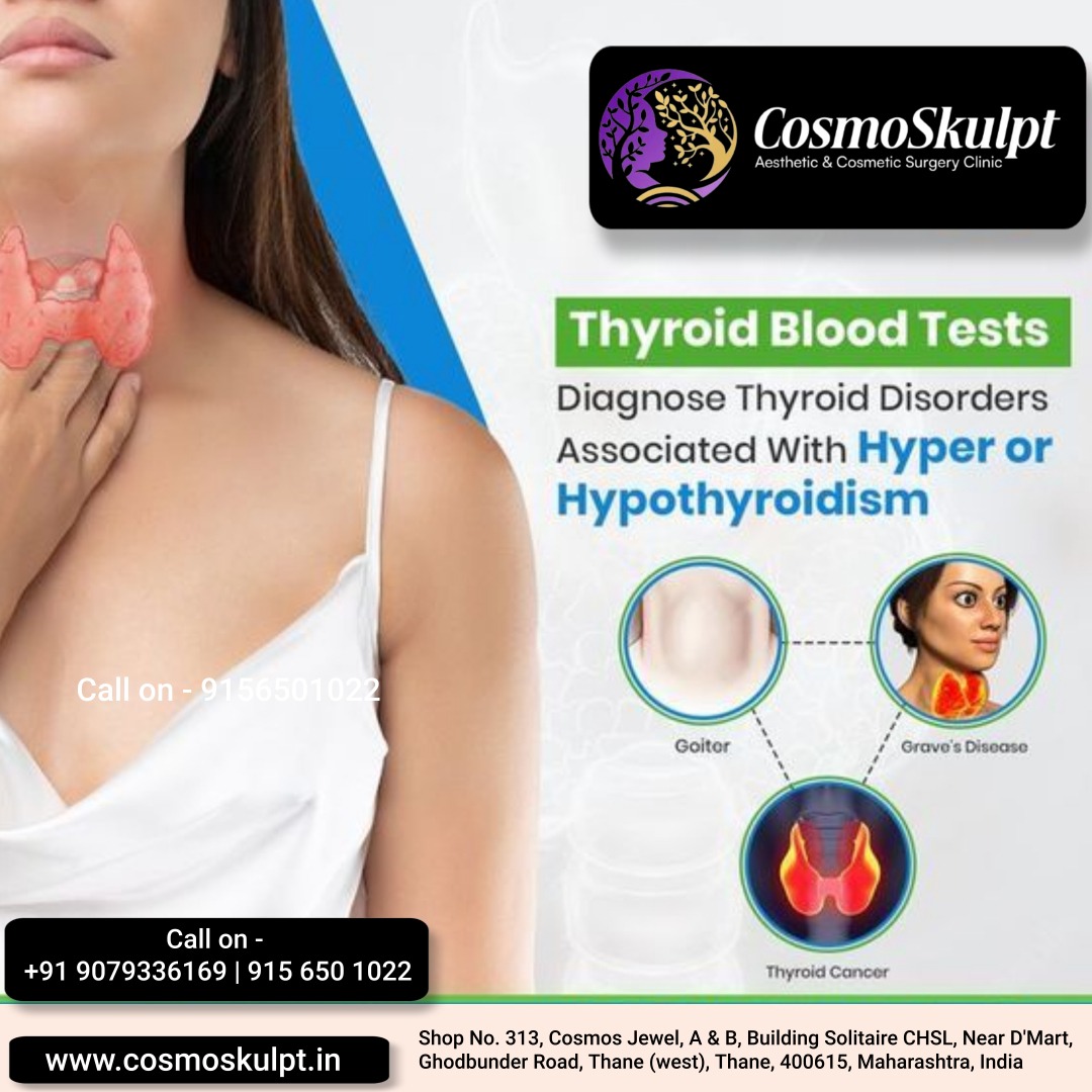  Discover Thyroid Wellness at CosmoSkulpt