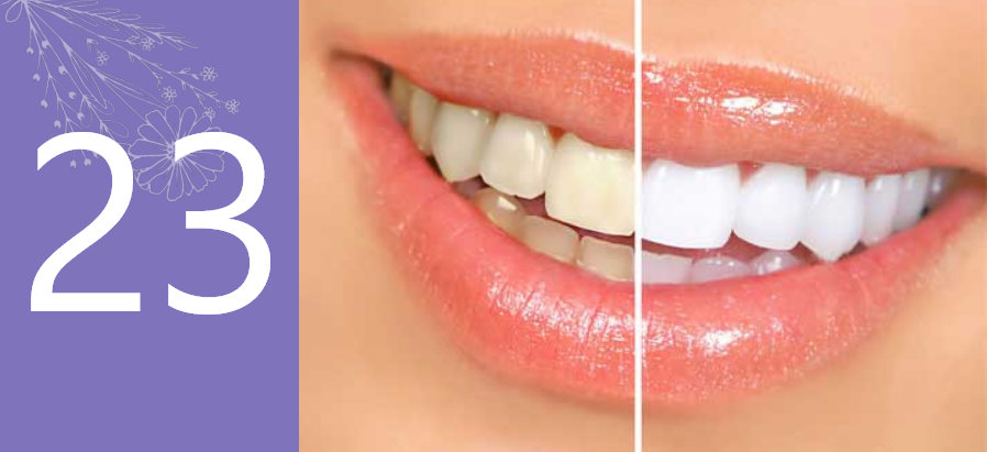 Scaling, Bleaching & Teeth whitening