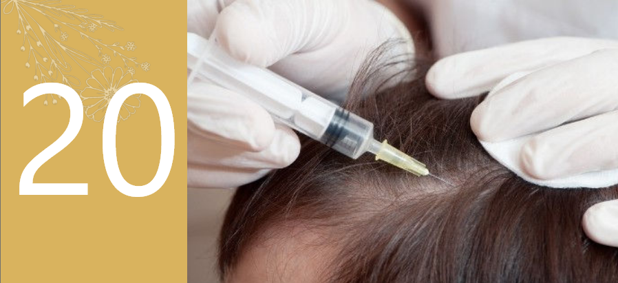 Steroid treatment for Alopecia